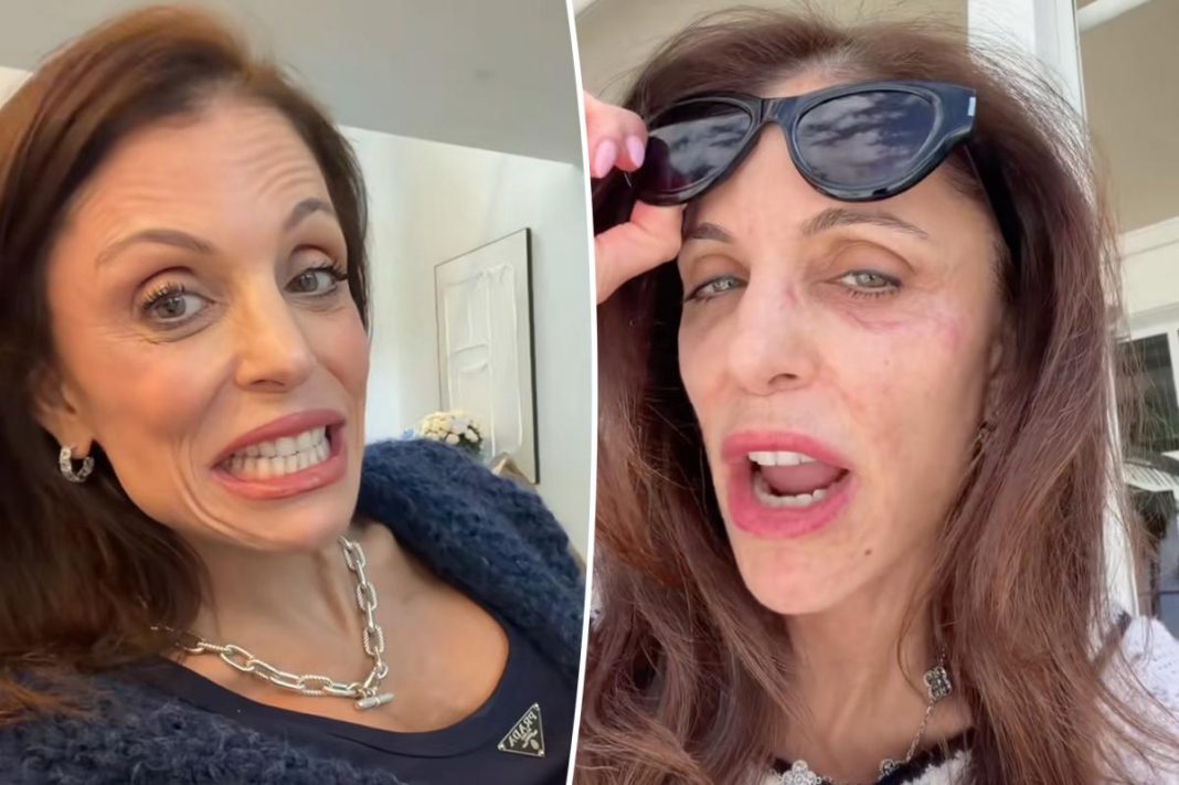 Bethenny Frankel says this common item is to blame for her facial bacterial infection