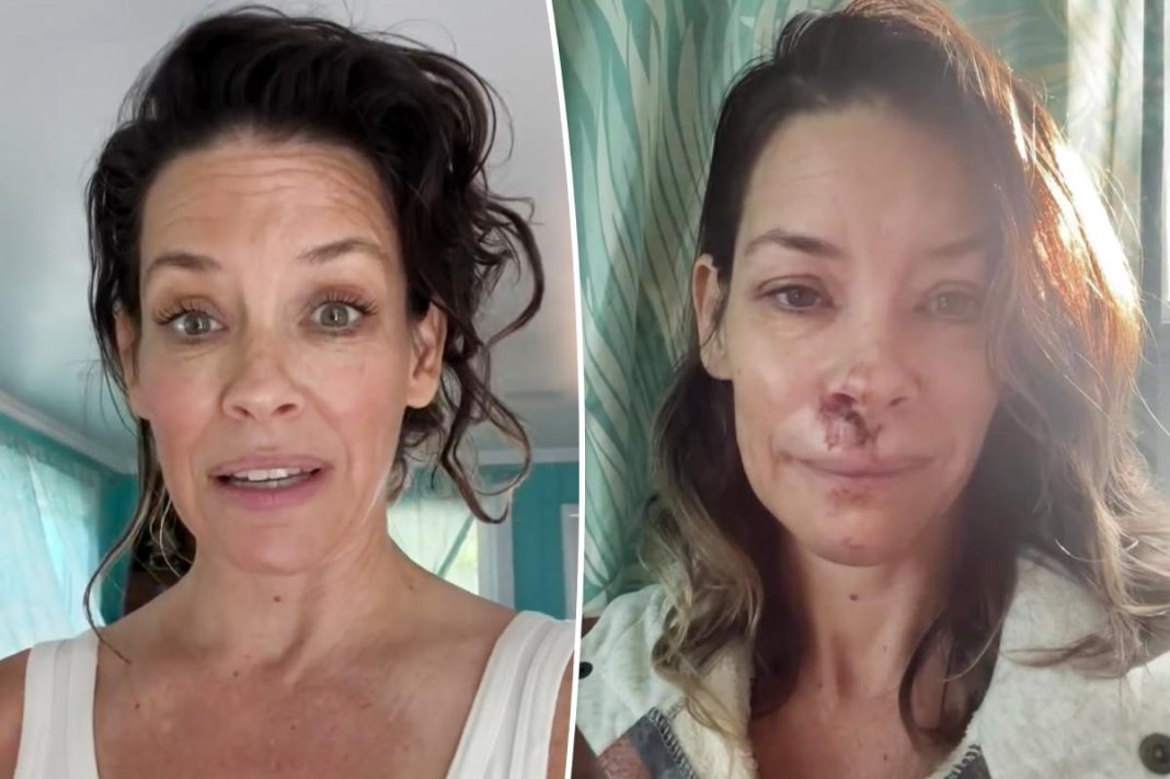 Evangeline Lilly shares treatment plan after traumatic brain injury: ‘I have spent a lot of money’
