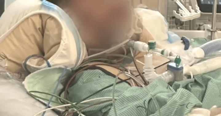 ‘You don’t think it will happen to you’: father warns after son hit by bus while wearing headphones