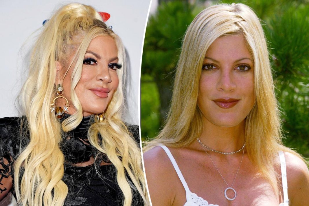 Tori Spelling sets record straight on fillers after ‘horrific’ comments about her appearance