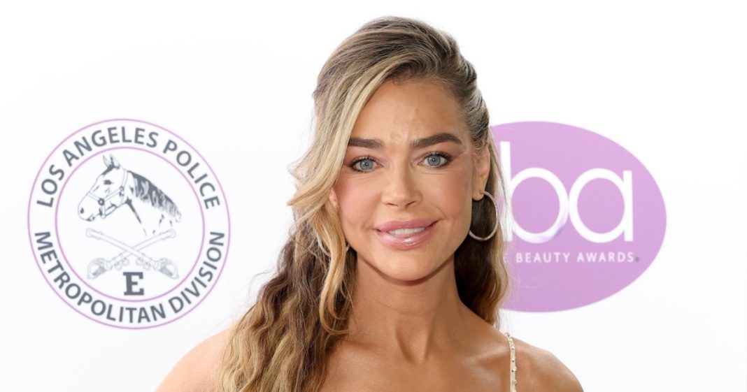 Denise Richards Reveals Jaw-Dropping Before-and-After Facelift Photos
