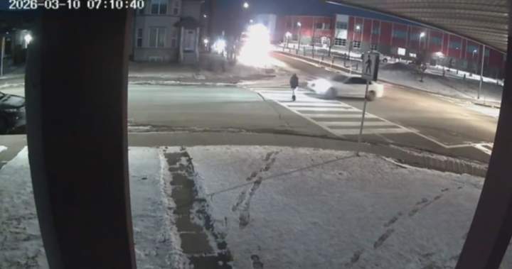 ‘Then he ran over my leg’: Calgary boy hit in crosswalk recovering at home