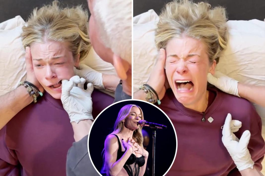 Experts weigh in on LeAnn Rimes’ emotional reaction to jaw release therapy: ‘Sympathetic response’