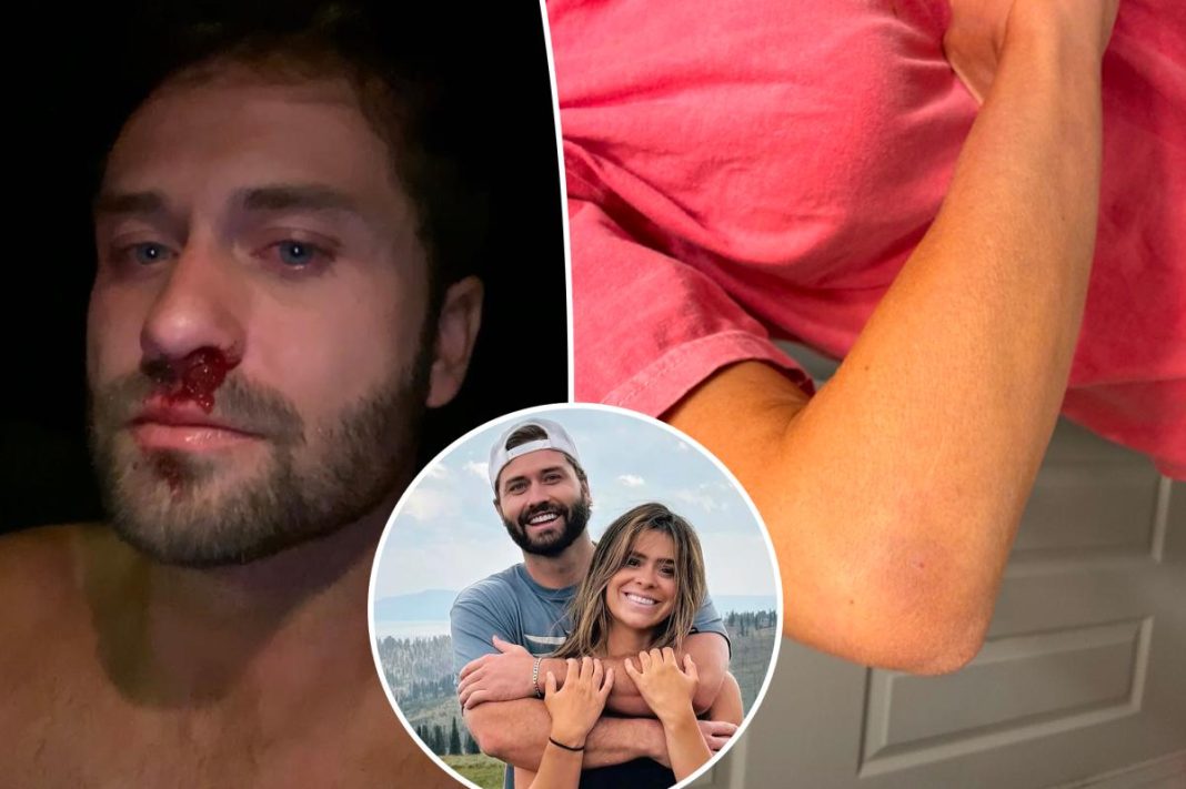 Taylor Frankie Paul and Dakota Mortensen showcase gruesome, bloody injuries from alleged domestic violence incidents