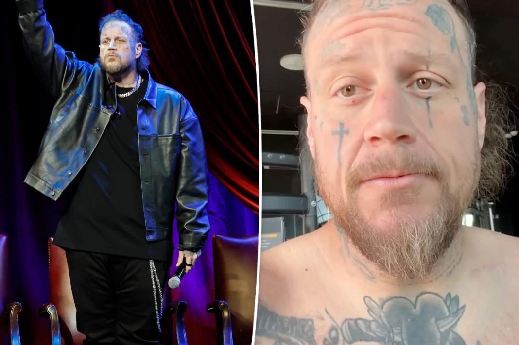 ‘Scared’ Jelly Roll details major setback in weight loss journey: ‘Lost my way’