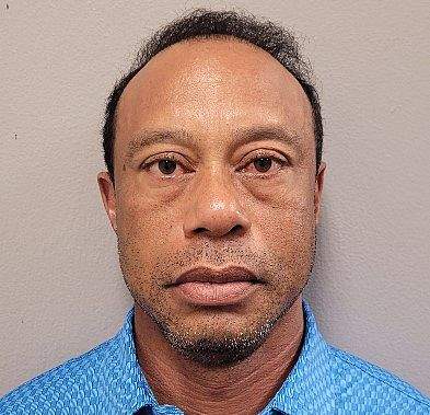 Tiger Woods had ‘glassy’ eyes, pills in pocket during DUI arrest: police