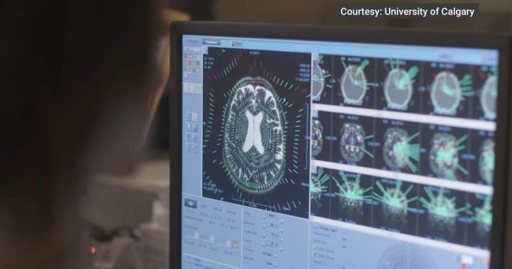 Calgary philanthropist’s legacy inspires life-changing mental health research