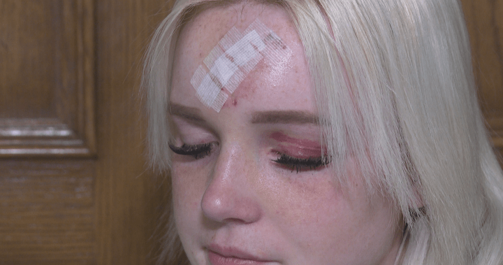 Okotoks family speaks out after driver hits a teen pedestrian from behind