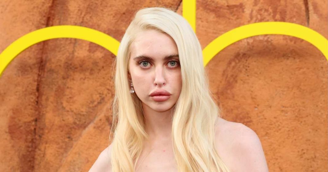 Euphoria’s Chloe Cherry Opens Up About Getting ‘So Much Lip Filler’ and Botox