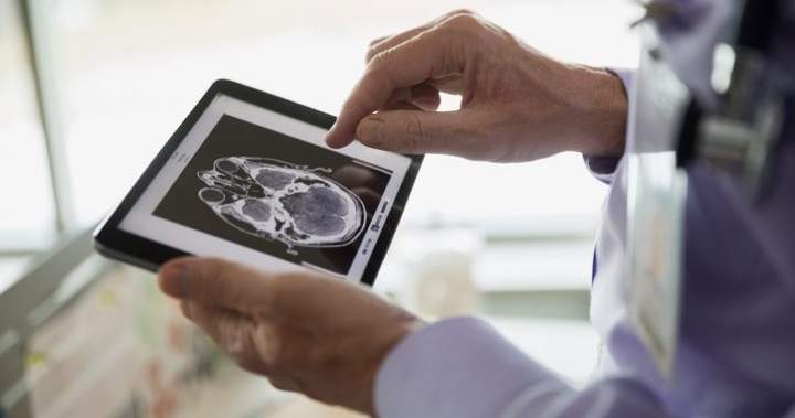 Doctors concerned as Alberta moves to fast‑track medical tests without referrals