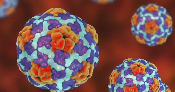 Manitoba health officials say ongoing hepatitis A outbreak has worsened