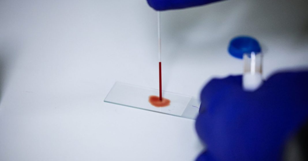 New Studies Found Your Blood May Hold Surprising Anti-Aging Power